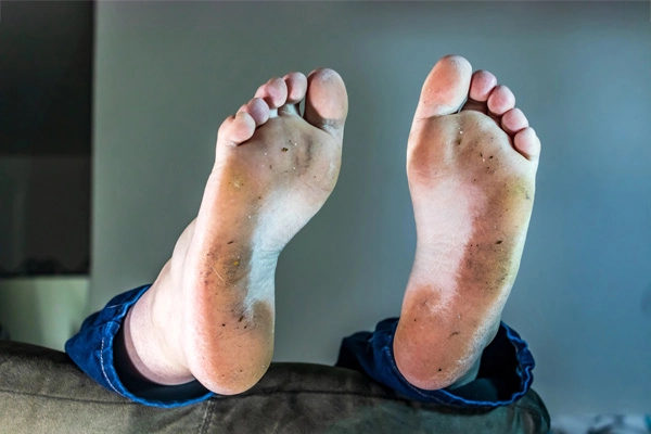 Dirty Feet